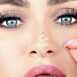 dry skin patches on face