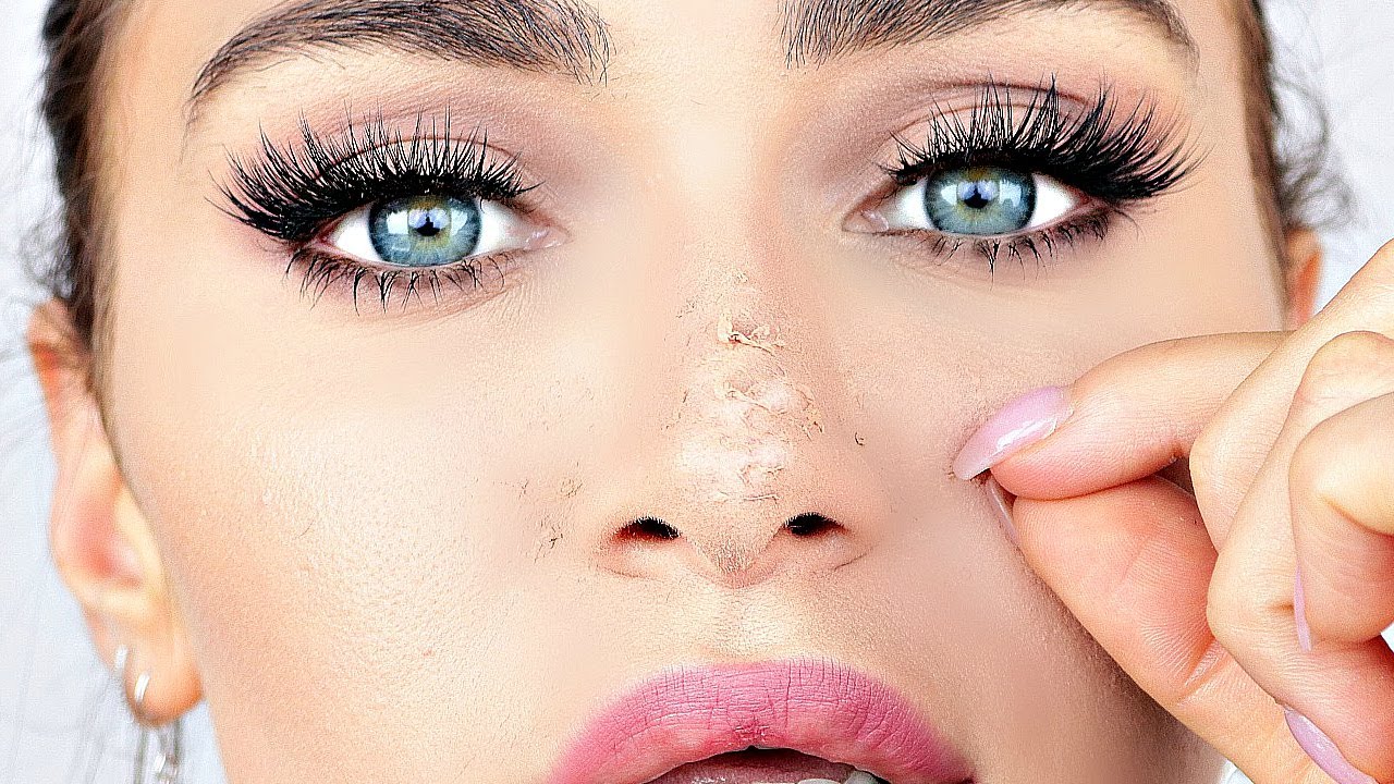 dry skin patches on face