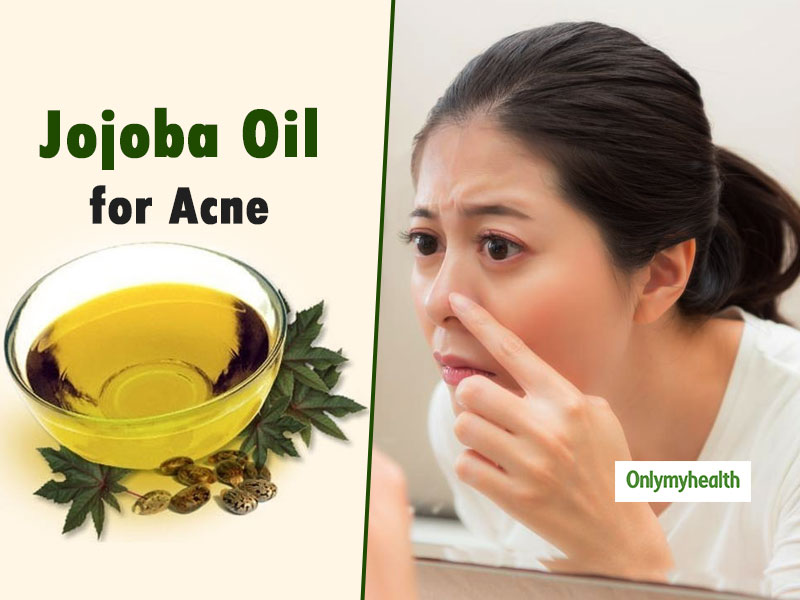 jojoba oil acne