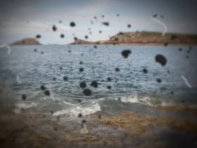 Can Dry Eyes Cause Floaters