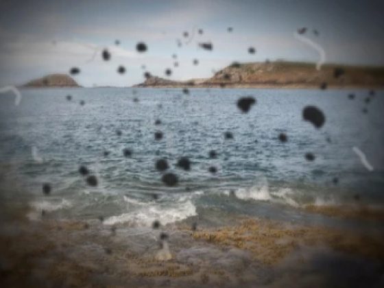 Can Dry Eyes Cause Floaters