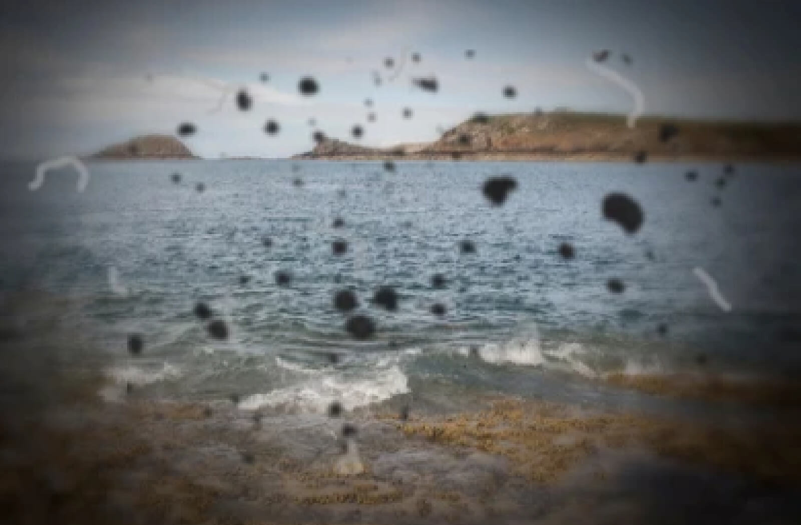 Can Dry Eyes Cause Floaters