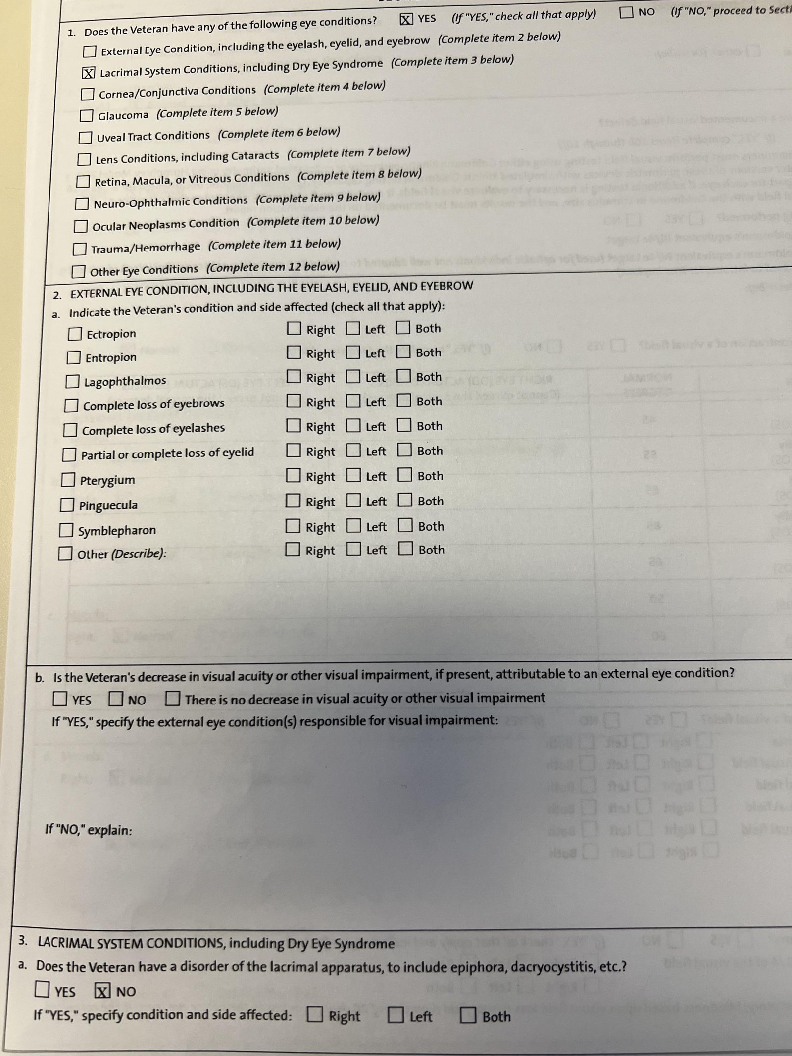 Dry Eyes Va Rating