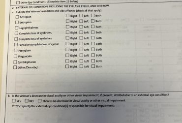 Dry Eyes Va Rating