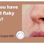 How to Treat Dry Skin around Nose