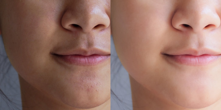 skin whitening treatment near me