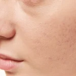 why do i have dry skin on my penis