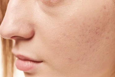 why do i have dry skin on my penis