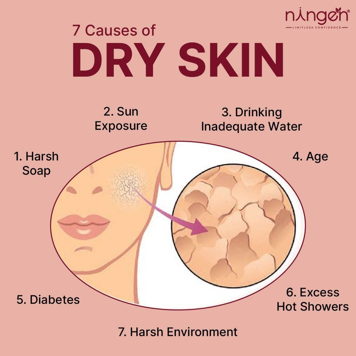 Causes of Dry Skin