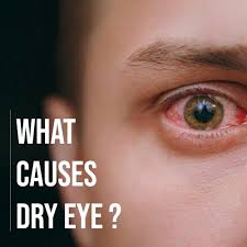 causes dry eyes