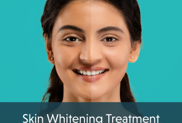 Permanent Skin Whitening Treatment Price