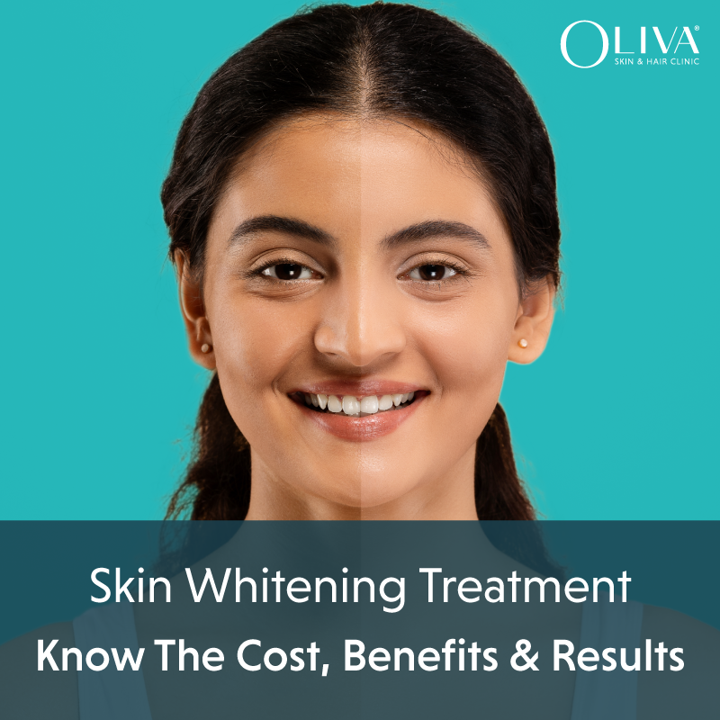 Permanent Skin Whitening Treatment Price