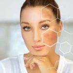 laser skin whitening treatment