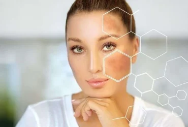 laser skin whitening treatment