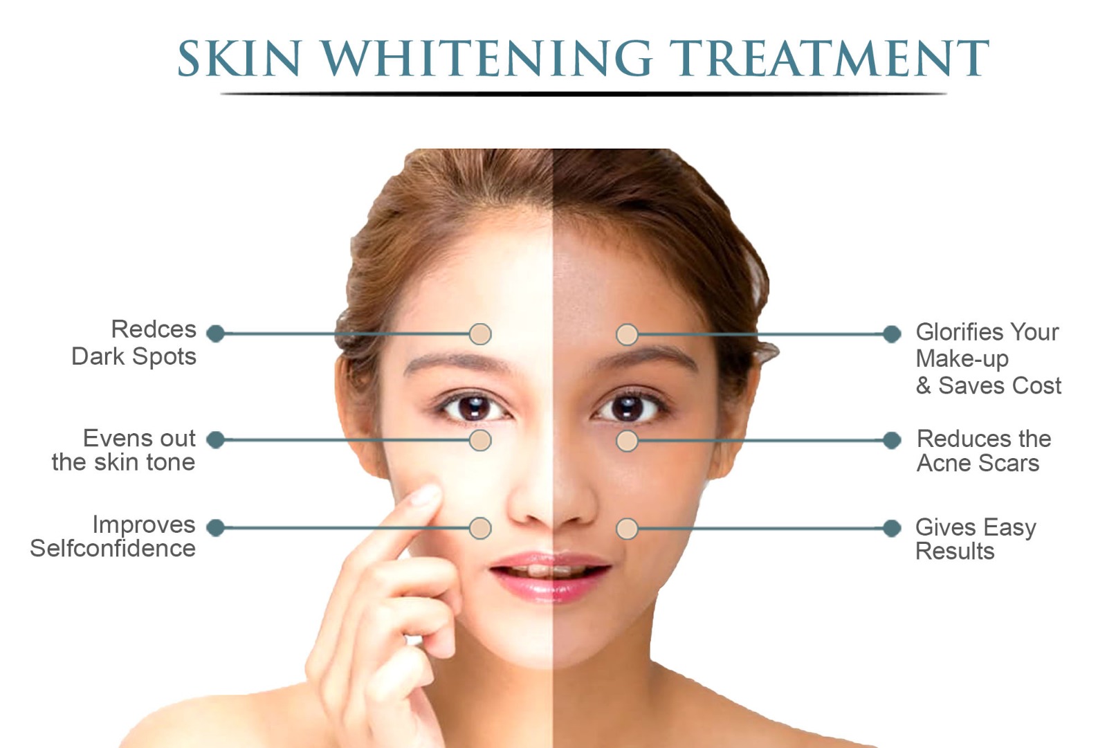 Treatments for Skin Whitening