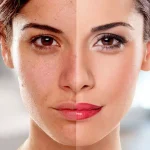 skin treatment for whitening