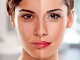 skin treatment for whitening