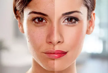 skin treatment for whitening