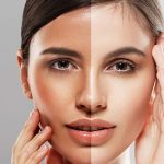 skin whitening laser treatment near me