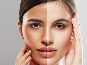 skin whitening laser treatment near me