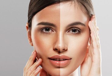 skin whitening laser treatment near me