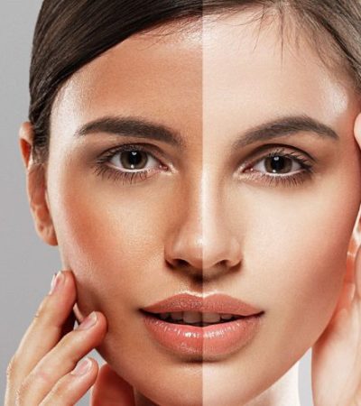 skin whitening laser treatment near me