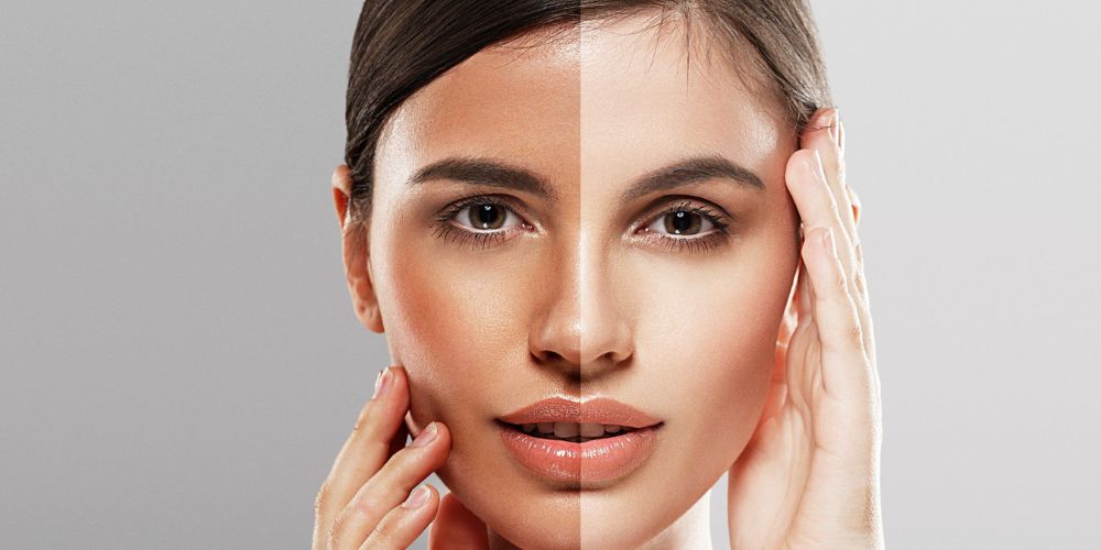 skin whitening laser treatment near me