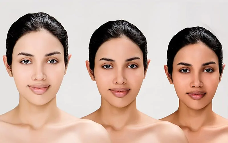 Skin Whitening Laser Treatment