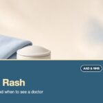 Dry skin rash guide: a folded cotton sleeve beside a ceramic jar on a pale surface